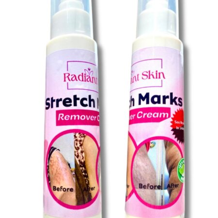 Radiant stretch marks cream (2 bottles)