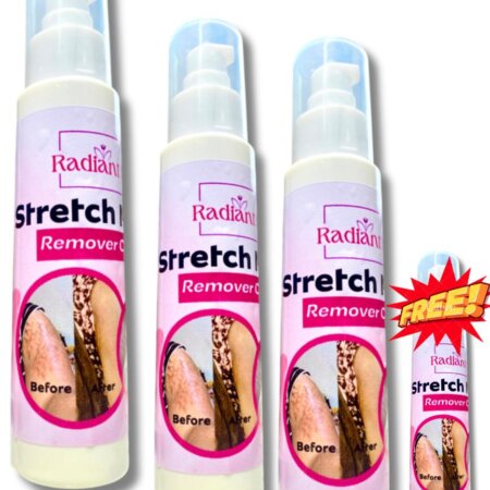 Radiant stretch marks cream (3 bottles + 1 Free)